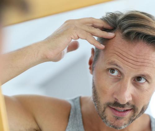 6 домашних средств от выпадения волос